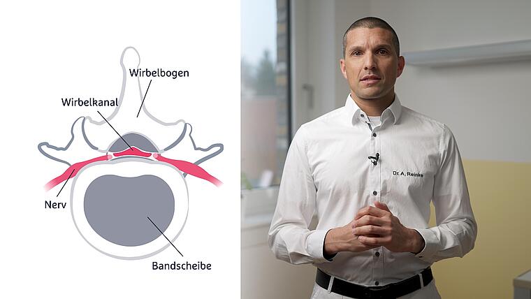 Klinik Vincentinum Augsburg Vorschau Spinalkanalstenos